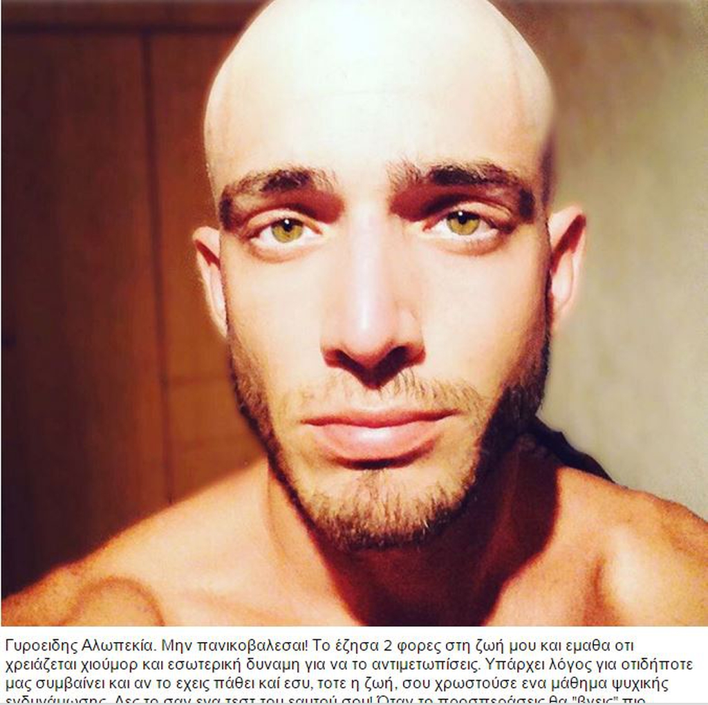 Θεοχάρης Ιωαννίδης: «Η πρώτη φορά που έχασα τα μαλλιά μου ήταν σοκ!»