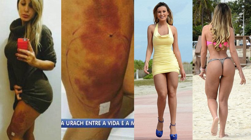 Η πρώην του Ρονάλντο σε κώμα μετά από επέμβαση πλαστικής!