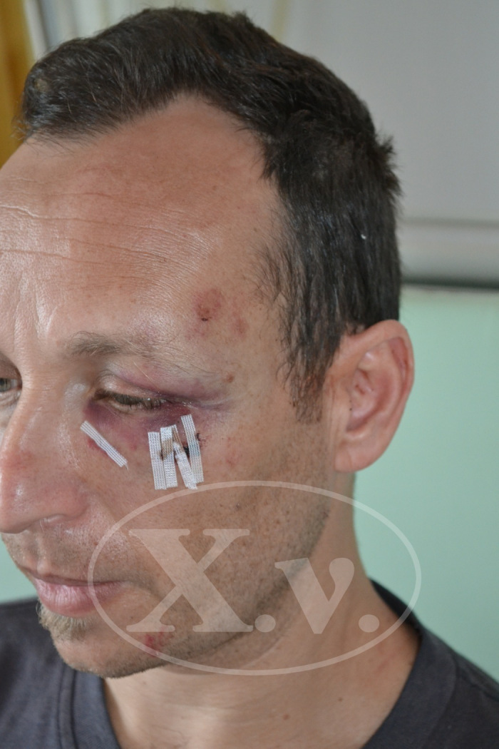 Χανιά: Παρασκευή μεσημέρι η δίκη για την επίθεση σε γιατρό