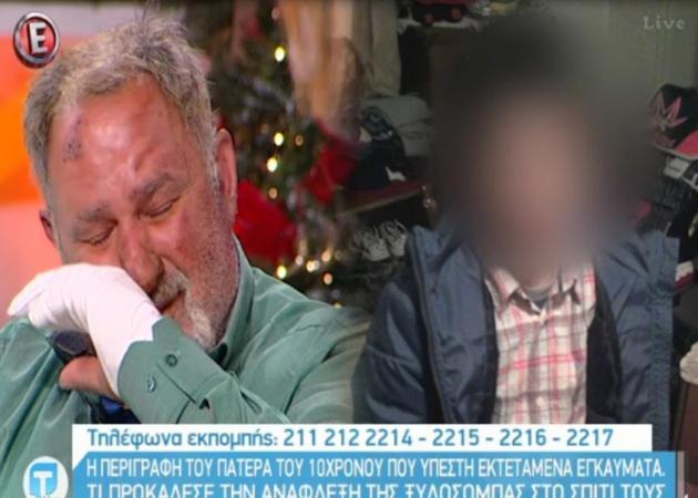 Κρήτη: Ξέσπασε σε δάκρυα ο πατέρας του 10χρονου που κάηκε στη φωτιά από τη ξυλόσομπα (Video)