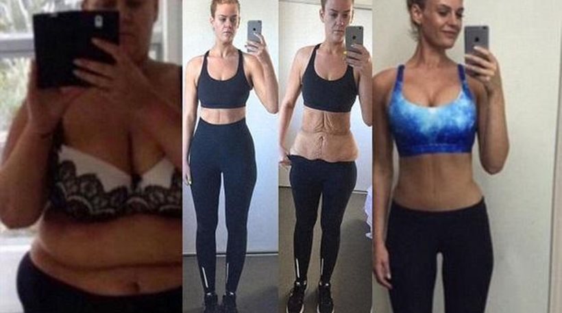 Έχασε 96 ολόκληρα κιλά και «ανέβασε» τη μεταμόρφωσή της στο Instagram
