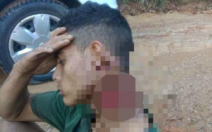 Νεαρός περπάτησε μισο-αποκεφαλισμένος μέσα στο δάσος για να σωθεί