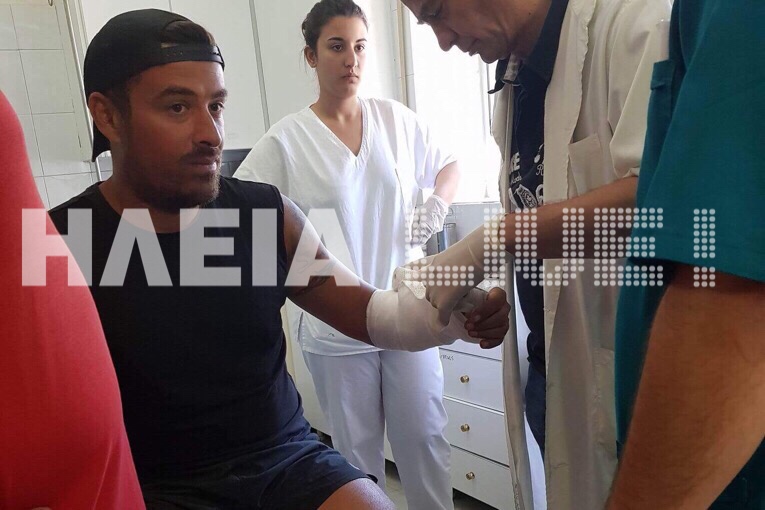 Στο νοσοκομείο ο Γιάννης Αϊβάζης μετά την ένταση στο Survival