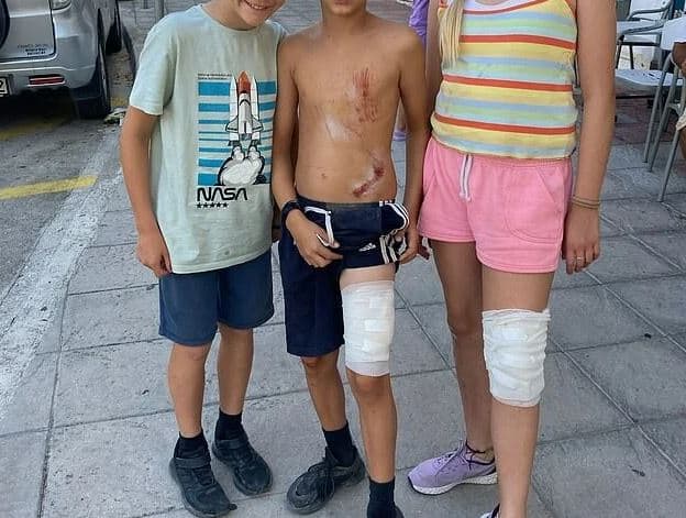 Επίθεση αγέλης σκύλων σε οικογένεια τουριστών - Τραυματίστηκαν δύο παιδιά και ένας άνδρας (φωτο)