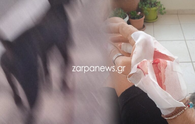 Χανιά: Σκύλος επιτέθηκε σε γυναίκα - “Τρέμω να βγω από το σπίτι” - Σοκάρει η καταγγελία της (φωτο)