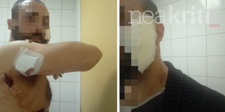 Κρήτη: Δάγκωσε και μαχαίρωσε ο πρώην τον νυν - Αναζητείται ο δράστης