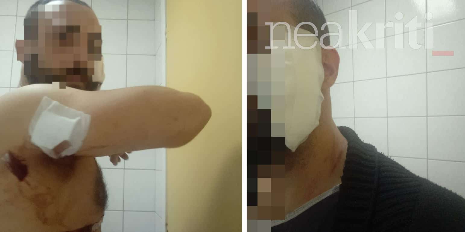 Κρήτη: Δάγκωσε και μαχαίρωσε ο πρώην τον νυν - Αναζητείται ο δράστης