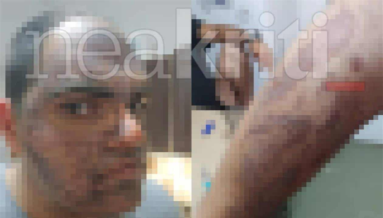 Κρήτη: Σοκ με εγκαύματα δευτέρου βαθμού ανασφάλιστος μάγειρας - Καυτό λάδι έκαψε 22χρονο σε κουζίνα ξενοδοχείου (video)