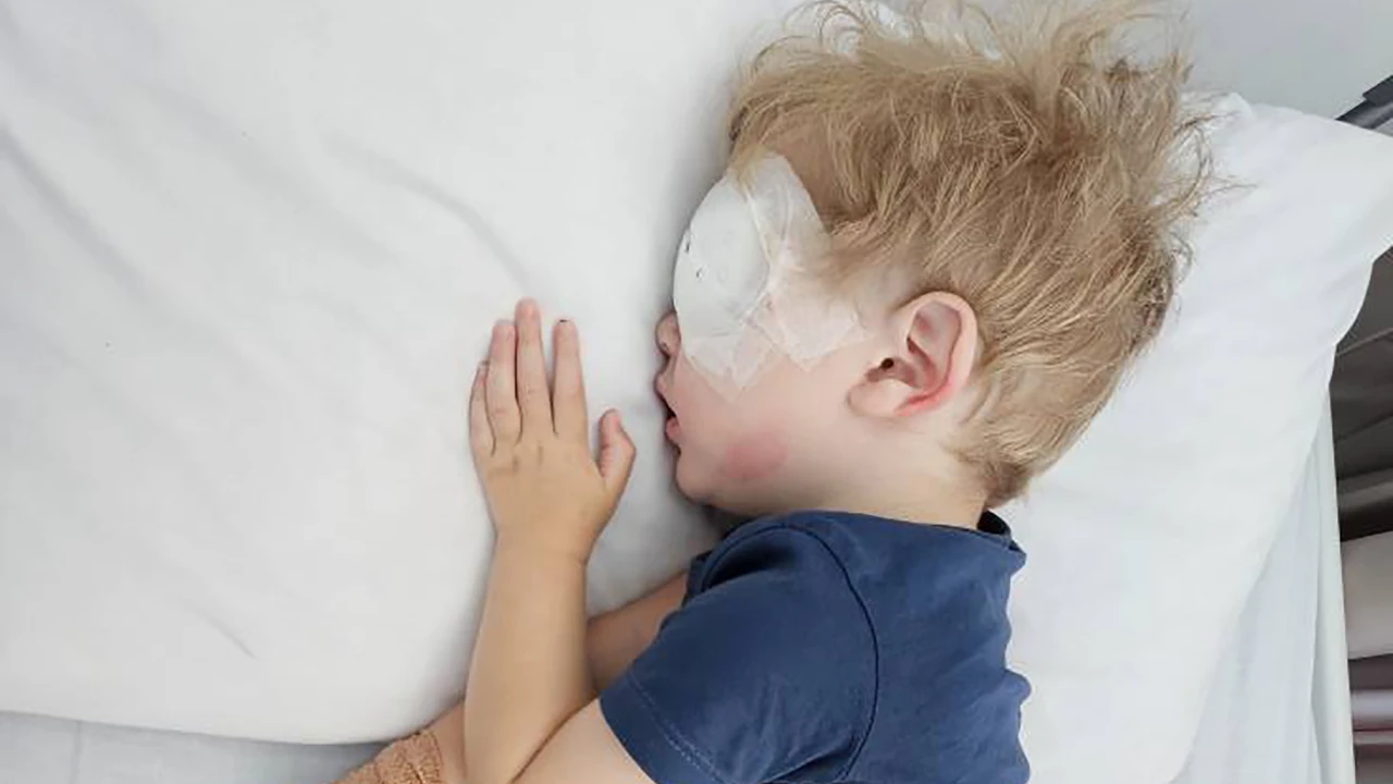 Σοκ - 2χρονο έχασε την όρασή του μετά από φιλί από άτομο με επιχείλιο έρπη (φωτο)