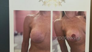 Αύξηση των περιστατικών καρκίνου στα Χανιά – Η ψυχολογική στήριξη «κλειδί» στην μάχη