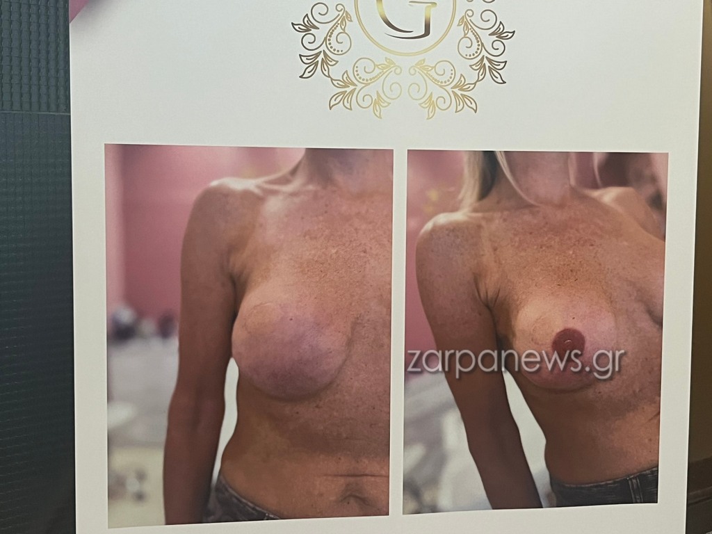 Αύξηση των περιστατικών καρκίνου στα Χανιά – Η ψυχολογική στήριξη «κλειδί» στην μάχη