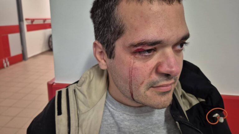 Χανιά: Διαλυμένο πεζοδρόμιο στη Νέα Χώρα λίγο έλειψε να στερήσει σε Χανιώτη την όρασή του! (φωτο)