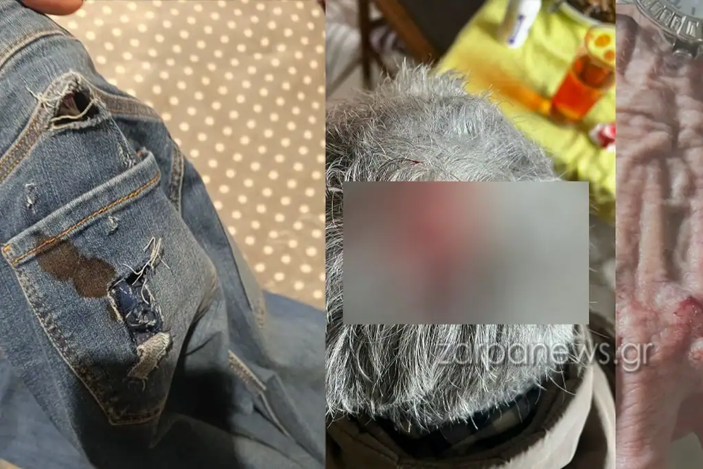 Χανιά: Σε κατάσταση σοκ και με σοβαρά τραύματα γυναίκα μετά από άγρια επίθεση σκύλων «θηρίων» 80 κιλών