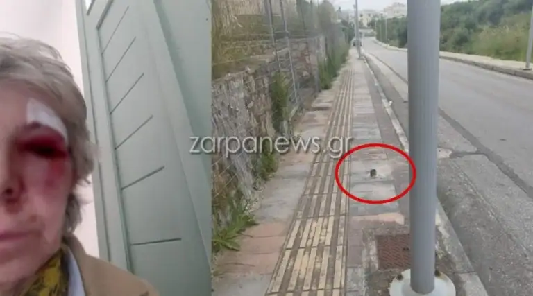 η γυναίκα έχει τραύματα με μώλωπες γύρω από τα μάτια και ράμματα