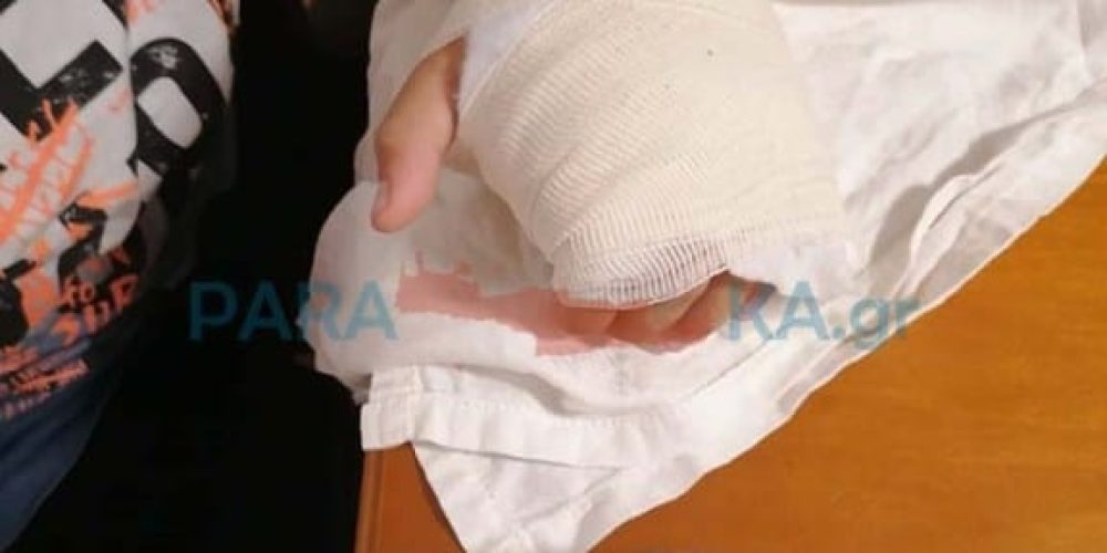 Χανιά: Επεσε μηχάνημα γυμναστικής και τραυματίστηκε παιδί (φωτο)