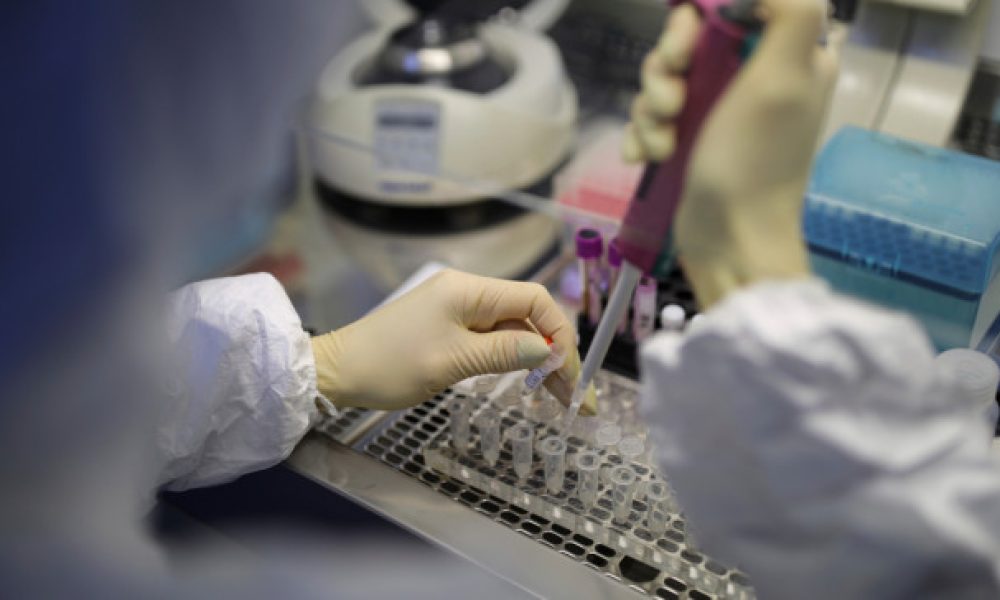 Κορωνοϊός: Το Ινστιτούτο Παστέρ προβλέπει ύφεση το καλοκαίρι και Εμβόλιο το φθινόπωρο