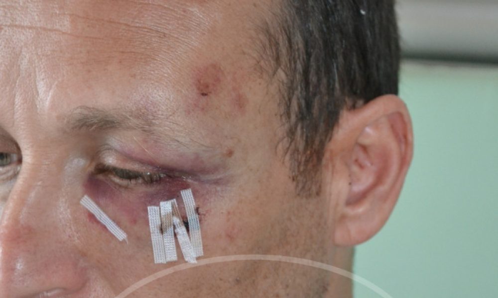 Χανιά: Παρασκευή μεσημέρι η δίκη για την επίθεση σε γιατρό