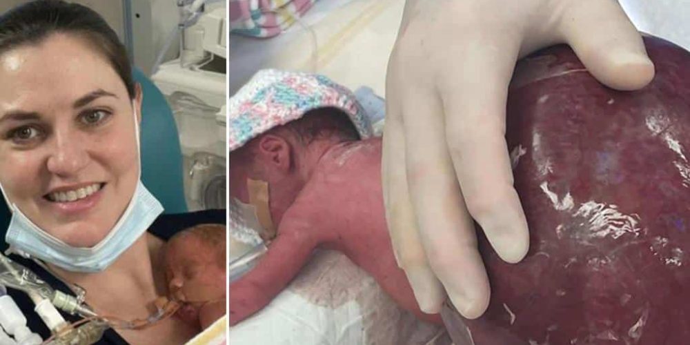 Το «μωρό θαύμα» που γεννήθηκε πρόωρα με έναν όγκο διπλάσιο από το μέγεθός του (video)