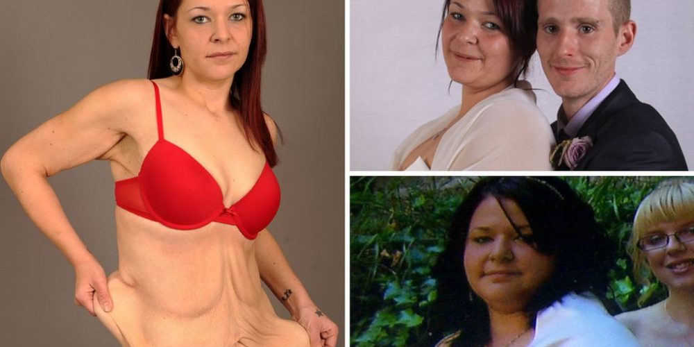 Έχασε 57 κιλά και καταστράφηκε η σεξουαλική της ζωή.