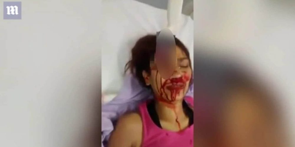 Βίντεο σοκ: Γυναίκα με μαχαίρι καρφωμένο στο φρύδι μετά από «επίθεση από τον μεθυσμένο σύζυγό της»