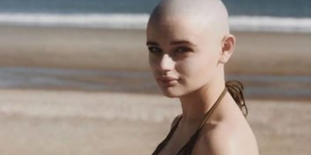 Ξύρισε το κεφάλι της για ρόλο και εκείνος φοβόταν να κάτσει δίπλα της «για να μην κολλήσει καρκίνο»