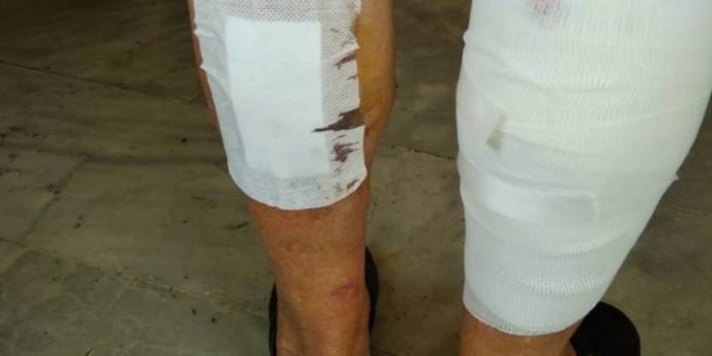 Χανιά: Κινδύνευσε η ζωή ηλικιωμένης από επίθεση αγέλης αδέσποτων! Την έστειλαν στο νοσοκομείο (Photos)
