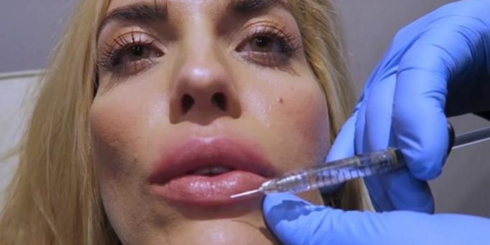 Μαντώ Γαστεράτου: Επισκέφθηκε τον πλαστικό χειρουργό και… φούσκωσε τα χείλη της on camera!