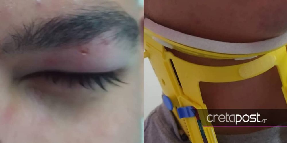 Απίστευτο περιστατικό στην Κρήτη – Οδηγός ξυλοκόπησε μαθητή επειδή του έκανε παρατήρηση για τη διάβαση πεζών (φωτο)