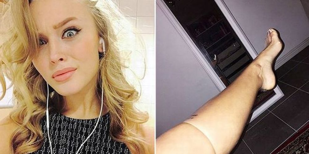 Σουηδή τραγουδίστρια φόρεσε στο πόδι της προφυλακτικό για να…