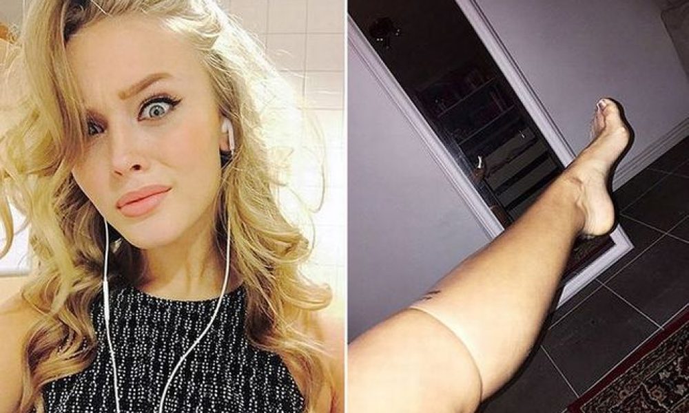 Σουηδή τραγουδίστρια φόρεσε στο πόδι της προφυλακτικό για να