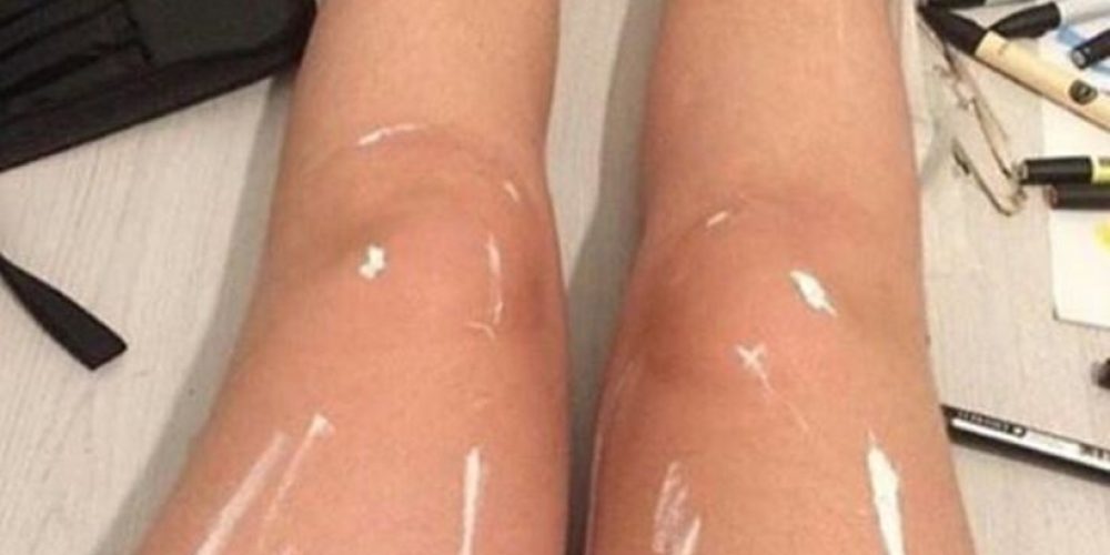 Η φωτογραφία που έγινε viral: Πόδια που… γυαλίζουν ή κάτι άλλο;