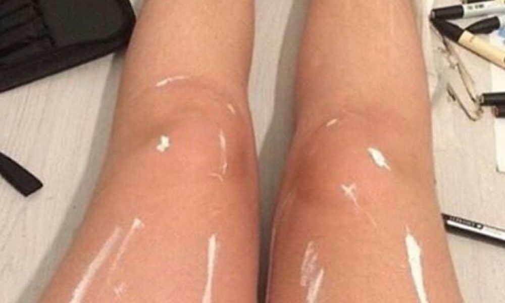 Η φωτογραφία που έγινε viral: Πόδια που... γυαλίζουν ή κάτι άλλο;