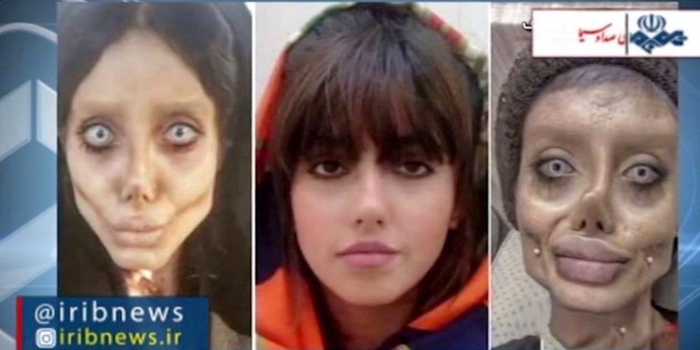 Η Ιρανή σταρ του Instagram που θύμιζε «ζόμπι εκδοχή» της Τζολί καταδικάστηκε σε δέκα χρόνια φυλακή