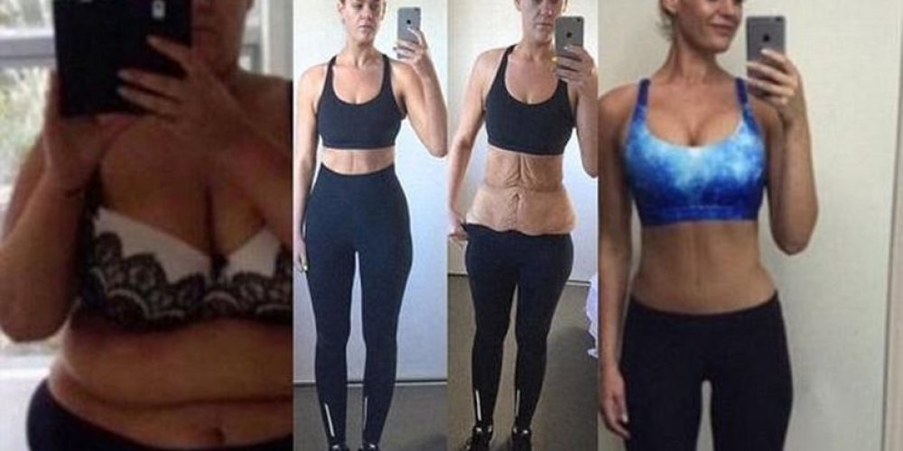 Έχασε 96 ολόκληρα κιλά και «ανέβασε» τη μεταμόρφωσή της στο Instagram