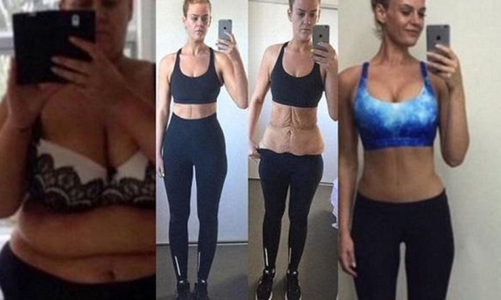Έχασε 96 ολόκληρα κιλά και «ανέβασε» τη μεταμόρφωσή της στο Instagram