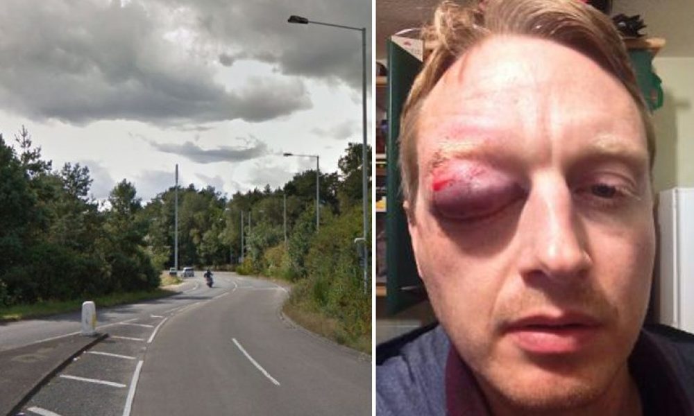 Ποδηλάτης κόντεψε να χάσει το μάτι του από αυγό που πετάχτηκε από διερχόμενο αυτοκίνητο (Photos)