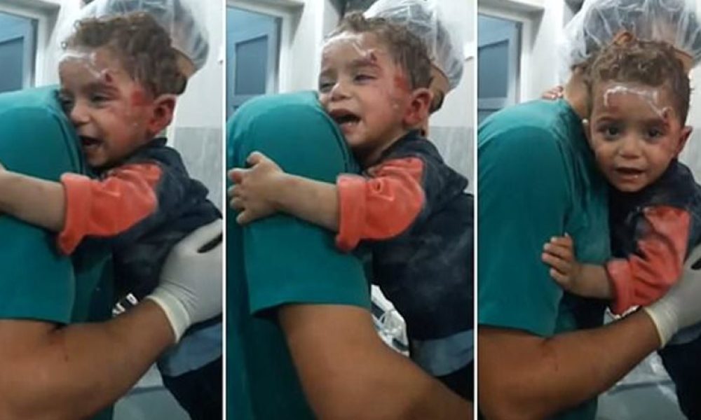 Συρία: Τραυματισμένο παιδί αρνείται να αποχωριστεί τον νοσοκόμο που το φρόντισε