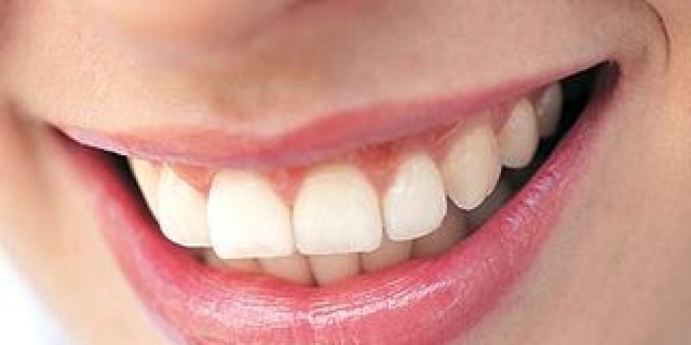 Ποιές τροφές είναι σοβαρή απειλή για τα δόντια;