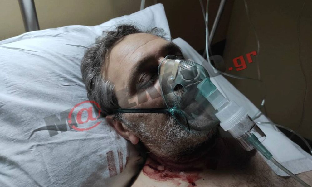 Δολοφονική επίθεση δέχτηκε ο δημοσιογράφος Στέφανος Χίος (Σκληρές εικόνες)