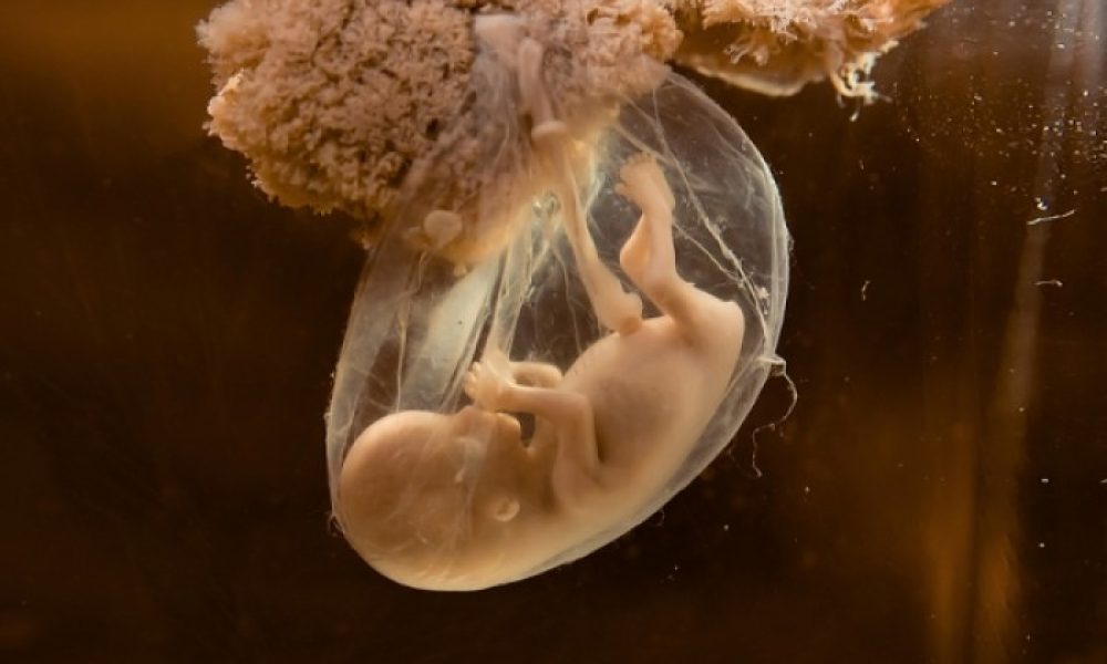 Τι συμβαίνει κατά την εκσπερμάτιση, τη γονιμοποίηση και την εγκυμοσύνη (βίντεο)