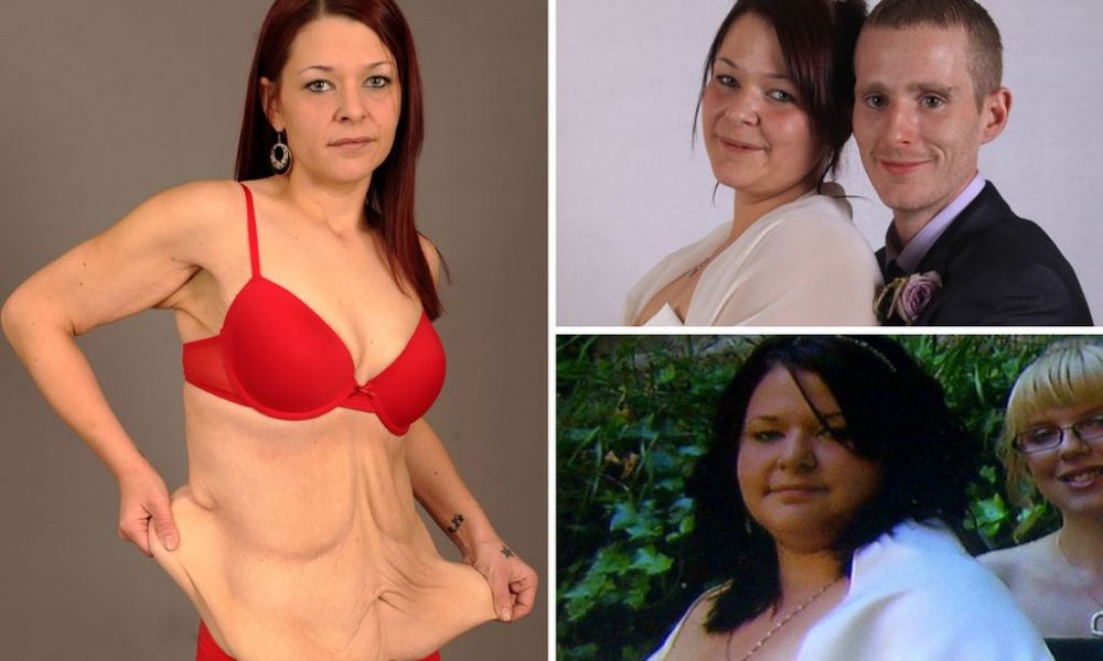 Έχασε 57 κιλά και καταστράφηκε η σεξουαλική της ζωή. Ντρέπομαι να γδυθώ μπροστά στον άντρα μου