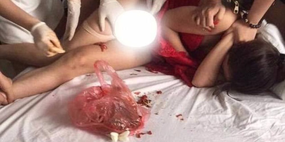 Eικόνες σοκ: Απατημένη σύζυγος έβαλε καυτερές πιπεριές στο αιδοίο της ερωμένης του άνδρα της
