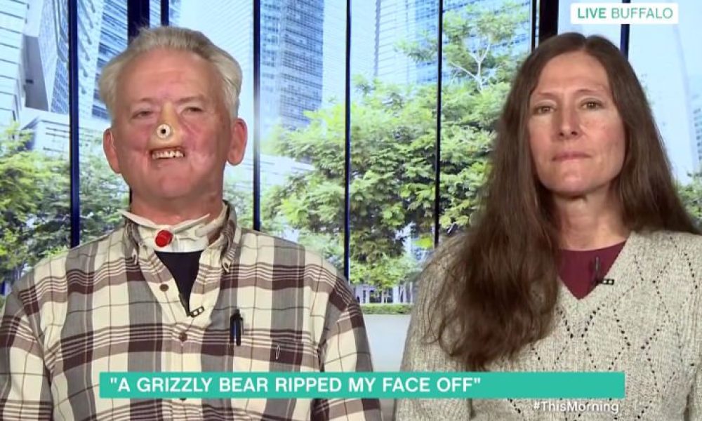 Ο κόσμος δεν δείχνει καμία συμπάθεια για τον κυνηγό που έχασε τη μύτη του από αρκούδα