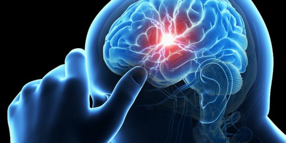 Εγκεφαλικό: Τα συμπτώματα και πώς να τα αναγνωρίσετε