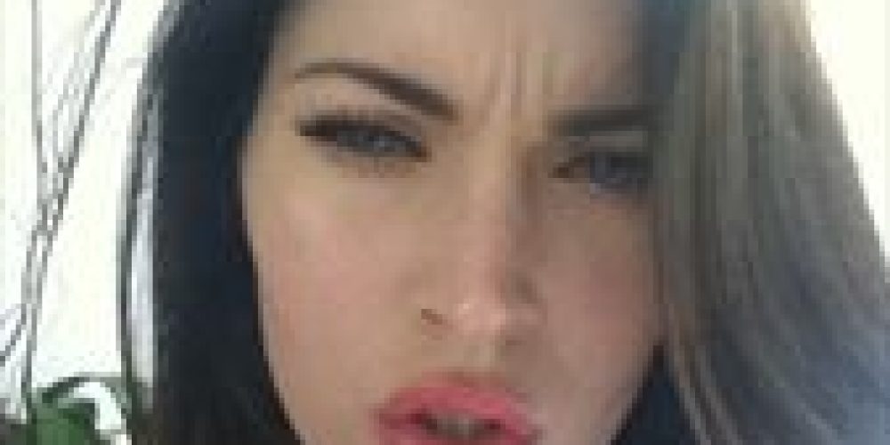 H Megan Fox φωτογραφίστηκε λόγω… botox!