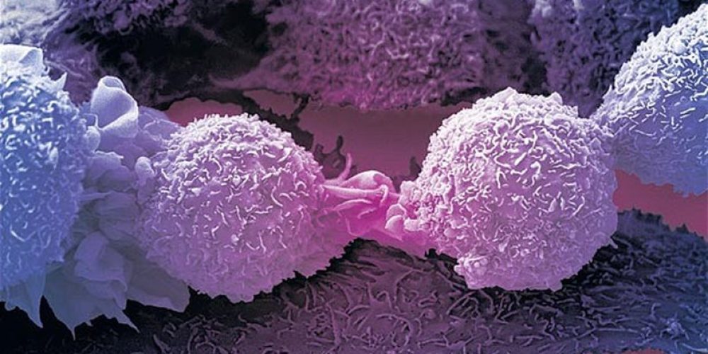 Έρευνα: Οι επιστήμονες βρήκαν την «αχίλλειο πτέρνα» όλων των καρκίνων
