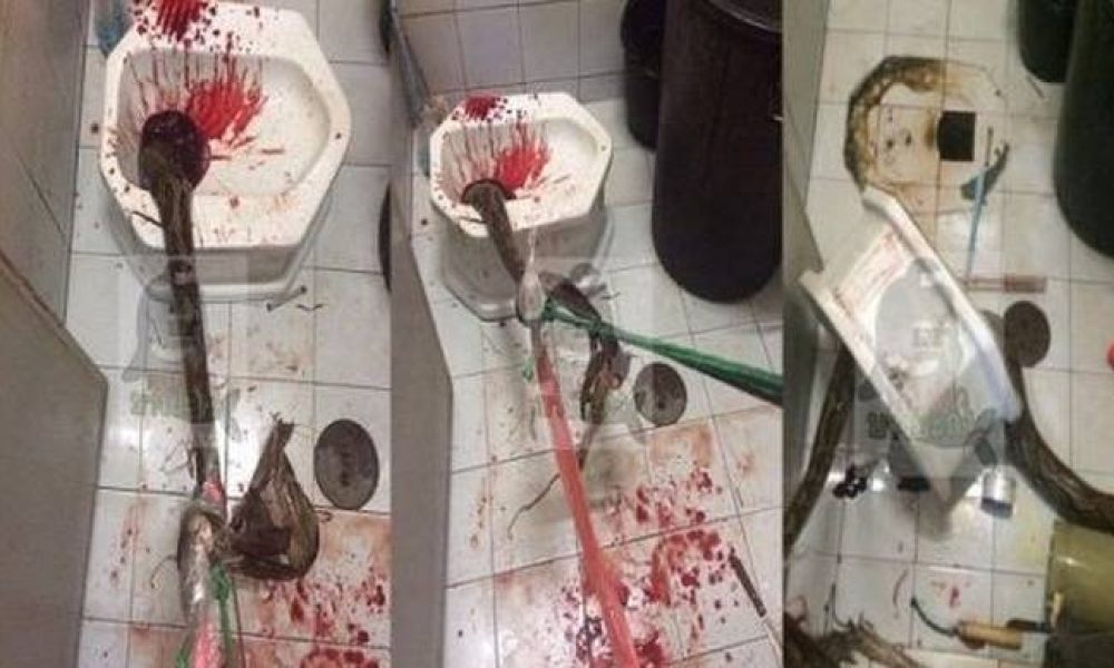 Τρόμος στην τουαλέτα: Πύθωνας τού δάγκωσε το… πέος! (ΣΚΛΗΡΕΣ ΕΙΚΟΝΕΣ)