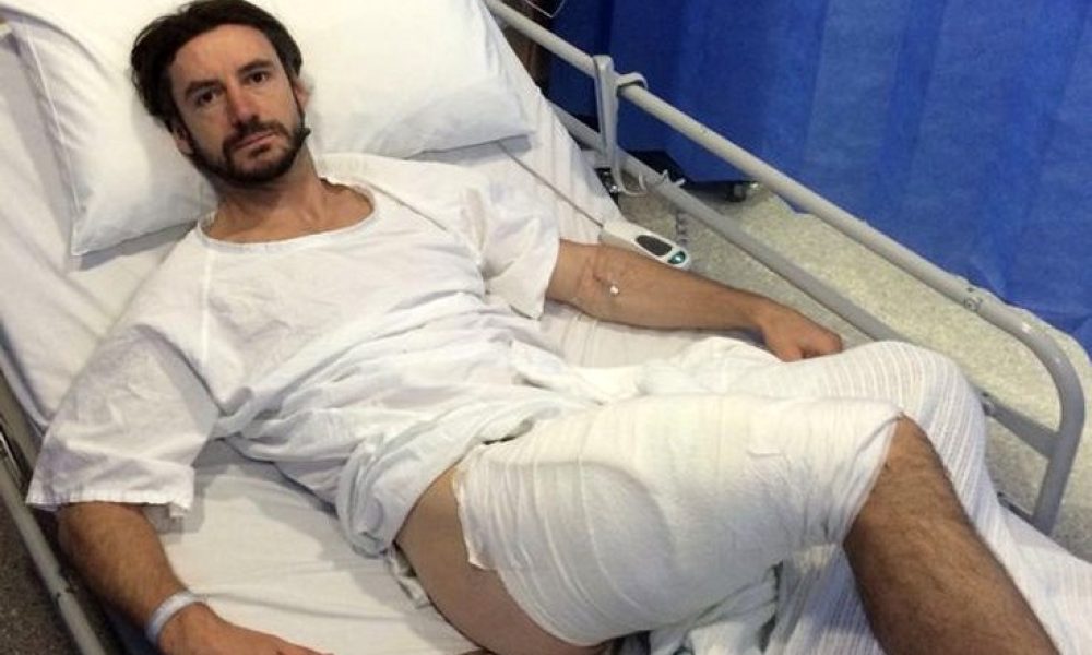 Βρετανός ποδηλάτης δείχνει πώς έγινε το πόδι του μετά από «έκρηξη» iPhone