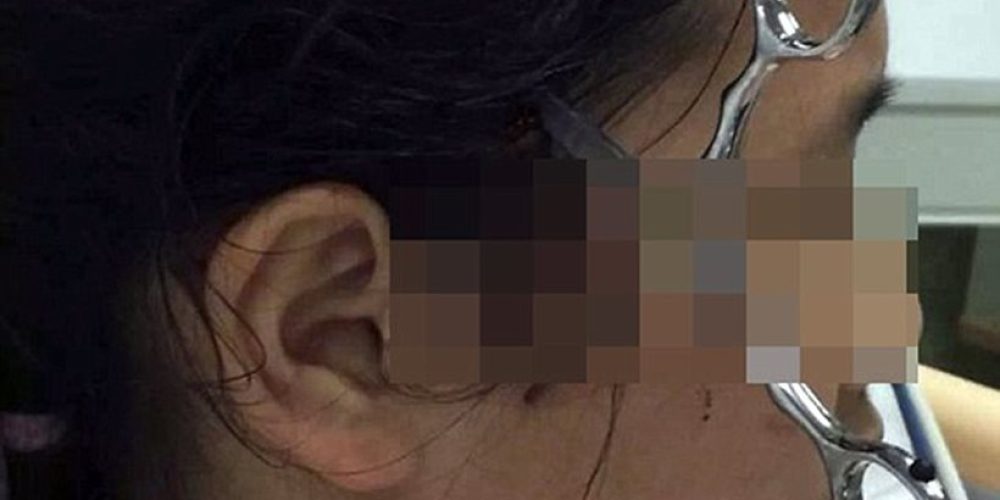 Σοκ: Πατέρας «κάρφωσε» ψαλίδι στο κεφάλι της κόρης του επειδή δεν διάβαζε τα μαθήματά της
