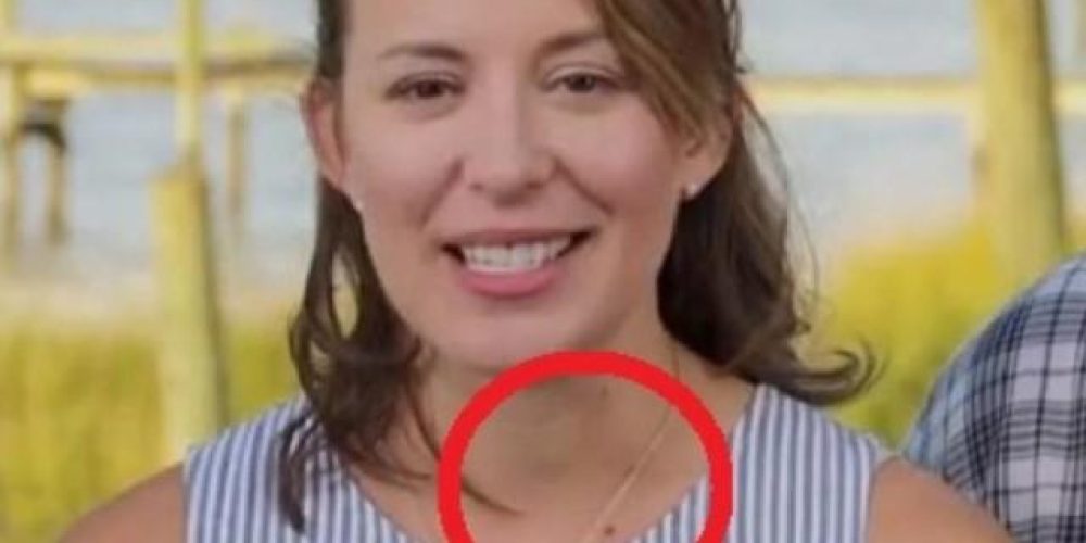 Γιατρός είδε αυτό σε γυναίκα που ήταν στην TV και την έσωσε από καρκίνο!(Video)